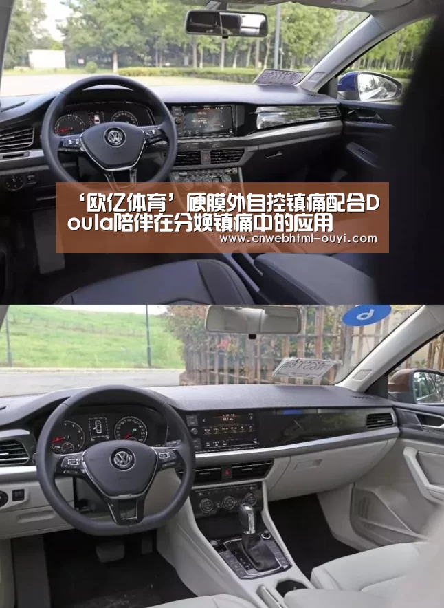 ‘欧亿体育’硬膜外自控镇痛配合Doula陪伴在分娩镇痛中的应用(图2) 欧亿体育部门